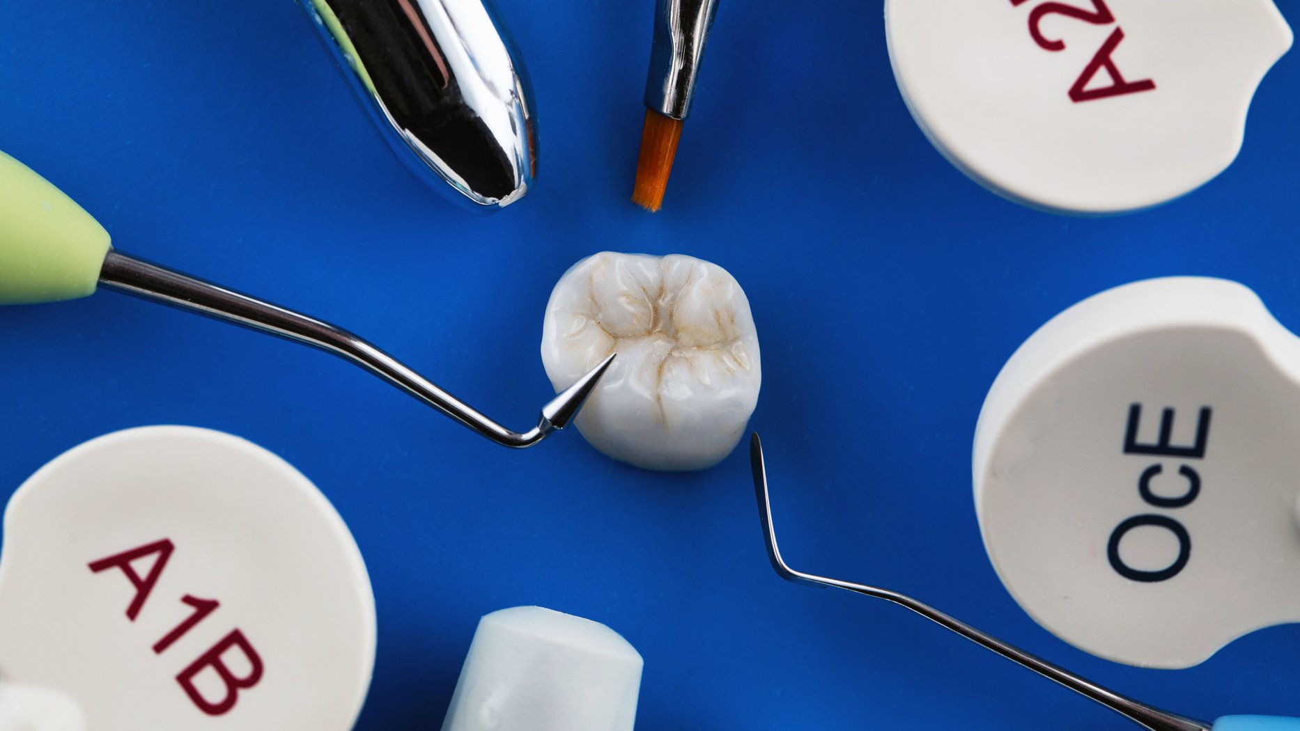 Excellent Composition of the Crown, around Dental Composites and